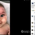 ‘Wounded’ infant photo has nothing to do with Palestine conflict